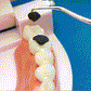 🔥 ¡Hoy, un 50 % de descuento! Juego de palillos de acero inoxidable reutilizables 🦷 Resistentes e higiénicos